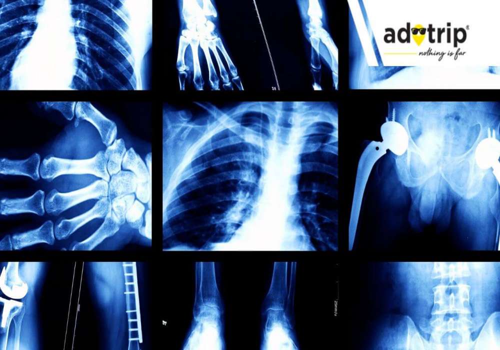 x-ray cost in india, x-ray test price in india